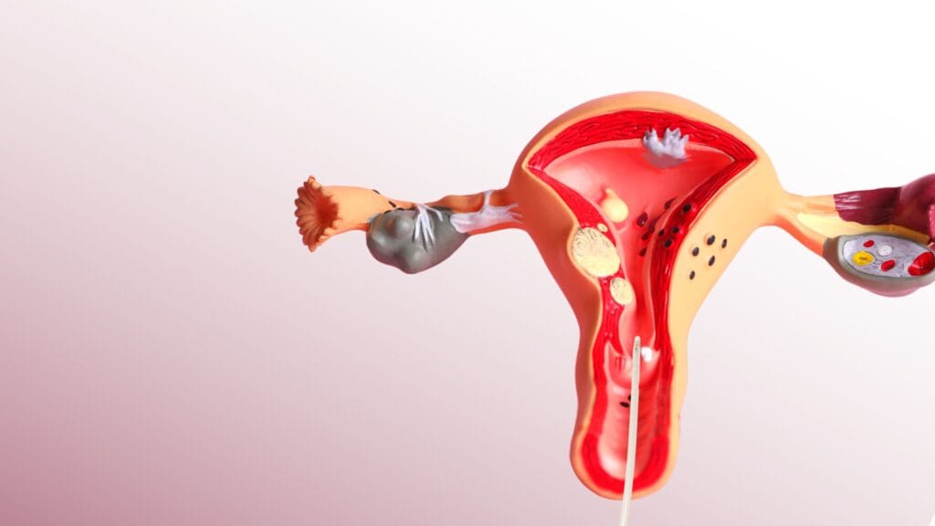 HISTEROSCOPIA. Entenda como esse procedimento ajuda na saúde feminina.