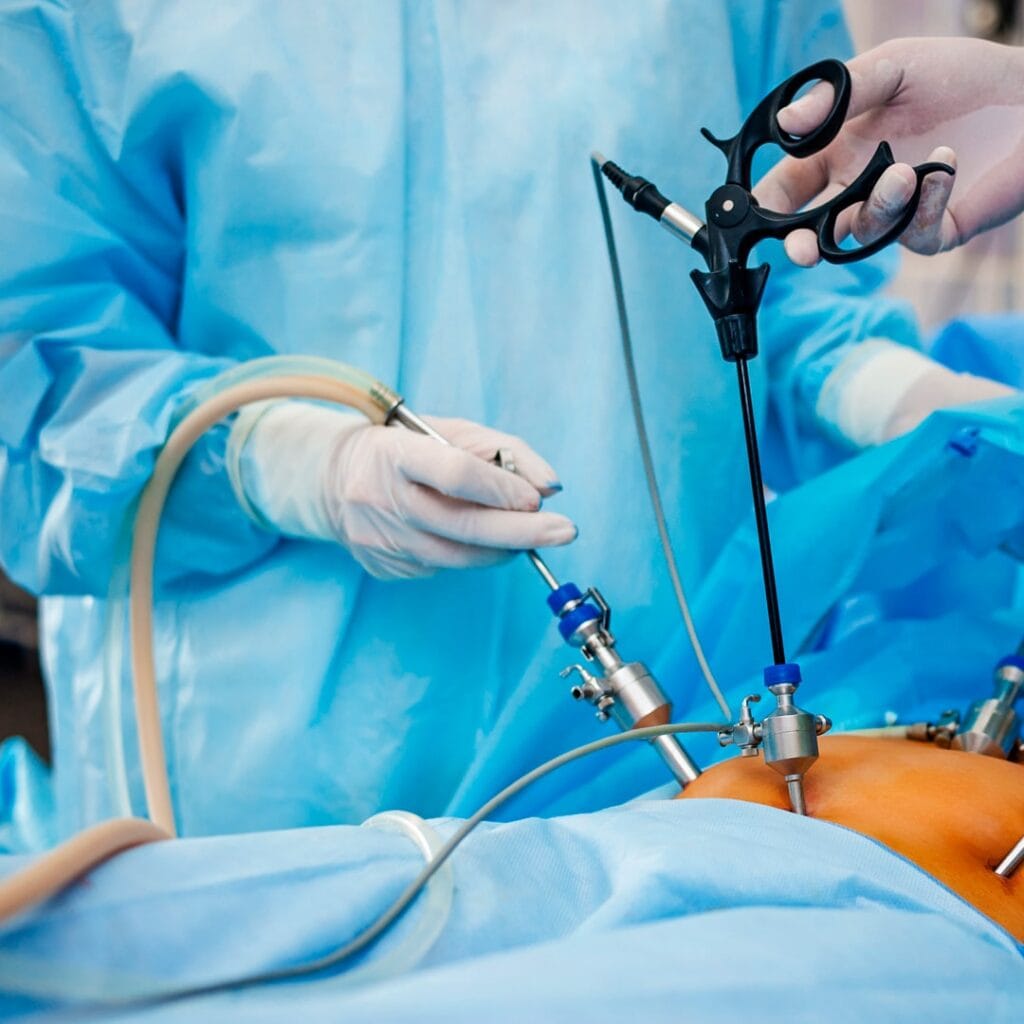 Cirurgia bariátrica: como fica o organismo no pós-operatório?