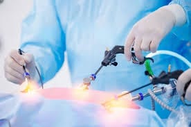 Videolaparoscopia na Ginecologia: como funciona, quando é indicada e o que muda na recuperação.
