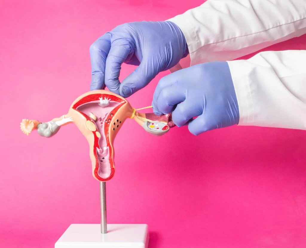 Imagem de órgão reprodutor feminino